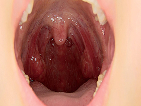 口臭押し潰し鼻舐めレズ サンプル動画サムネイル